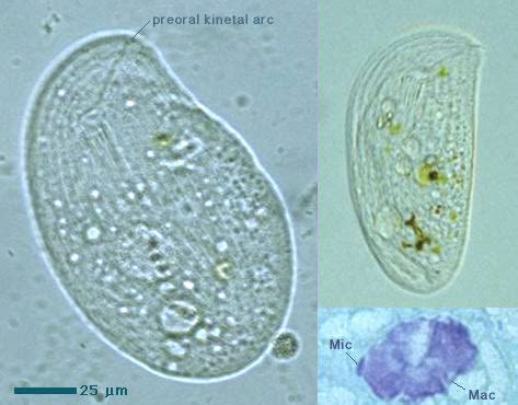  Chilodonella: Can You Imagine Swimming Through Water Using Tiny Hair-Like Structures?