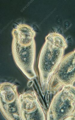  Zoom into the Microscopic World of Zoology:  Zoothamnium Discover How These Elegant Ciliates Flourish in Aquatic Environments!